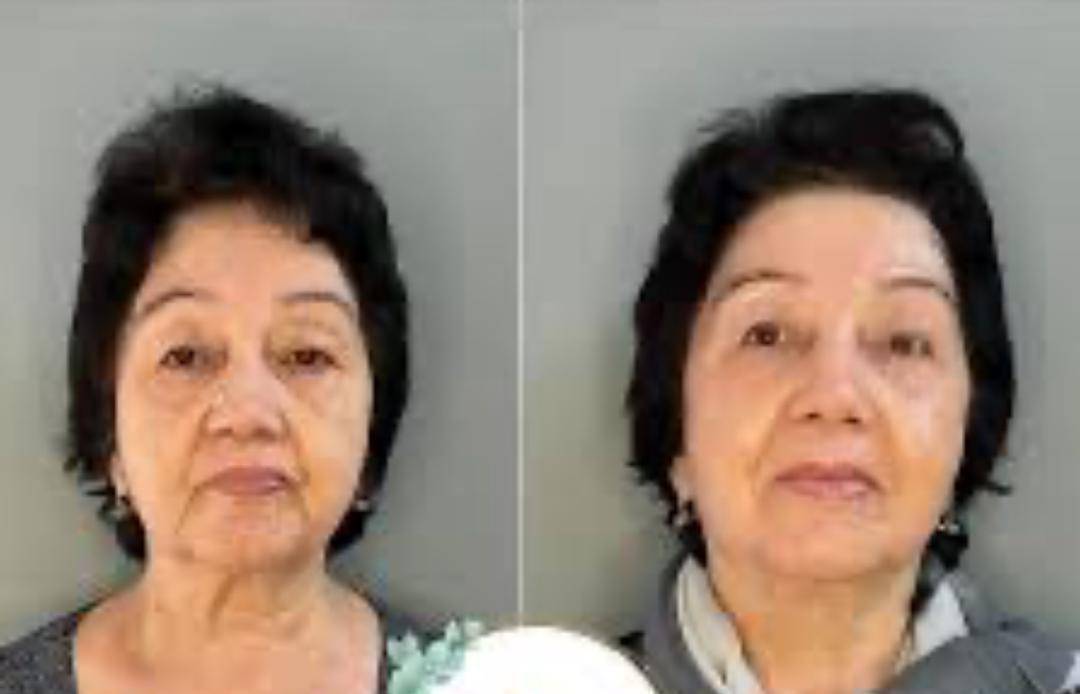 Бетиниздеги коллаген кайда кетти, эластичность жок, бетиниз томон тушкон,карайган жана тактар байкалып калса.сиздерде ушул жагдай тааныш болсо , анда бизге келип супер инновационный апарат эхвч менен бетинизди бир процедурадан кийин минус 10 жылга жашартып кетиниздер,, эч кандай зыяны жок, ийнесиз ,  оорусуз,ботоксуз процедурага
 жазылыныздар
Инстаграм:Cosmetolog_gulnura