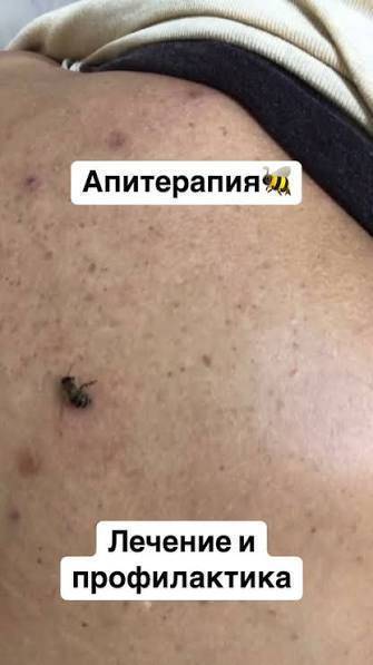 Бал аары керек чактырганга