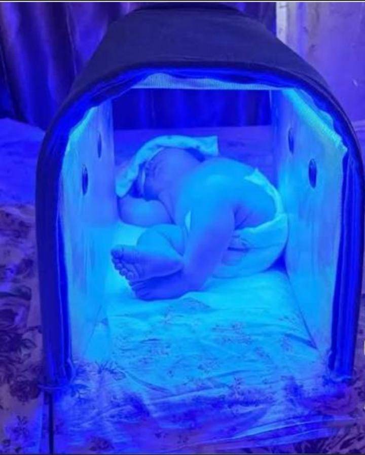 Фото лампа от желтухи 
Арендага берилет 0703149595