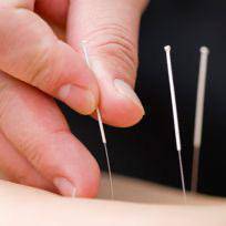 6-АПРЕЛДЕН 16-АПРЕЛГЕ ЧЕЙИН, КОРТЕКС КЛИНИКАСЫНАН ТАЖЫРЫЙБАЛУУ ИГЛОТЕРАПЕВТ - ДАРЫГЕРЛЕР ТОКТОГУЛ ШААРЫНА КЕЛИШЕТ. ИГЛОТЕРАПИЯ ТӨМӨНКҮ ООРУЛАРГА ЖАРДАМ БЕРЕТ:БЕЛ, МОЮН, ОМУРТКА ООРУЛАРЫНА,  БАШ ООРУЛАРГА,  НЕРВ СИСТЕМАСЫНЫН ООРУЛАРЫНА, КОЛ БУТТУН ООРУШУ, УЮШУ, СТРЕСС,  УЙКУСУЗДУК Ж.Б. КАБЫЛ АЛУУ ЧЕКТЕЛҮҮ, АЛДЫН АЛА ЖАЗЫЛЫП КОЮҢУЗДАР.
БАЙЛАНЫШ НОМЕР 0502 385050