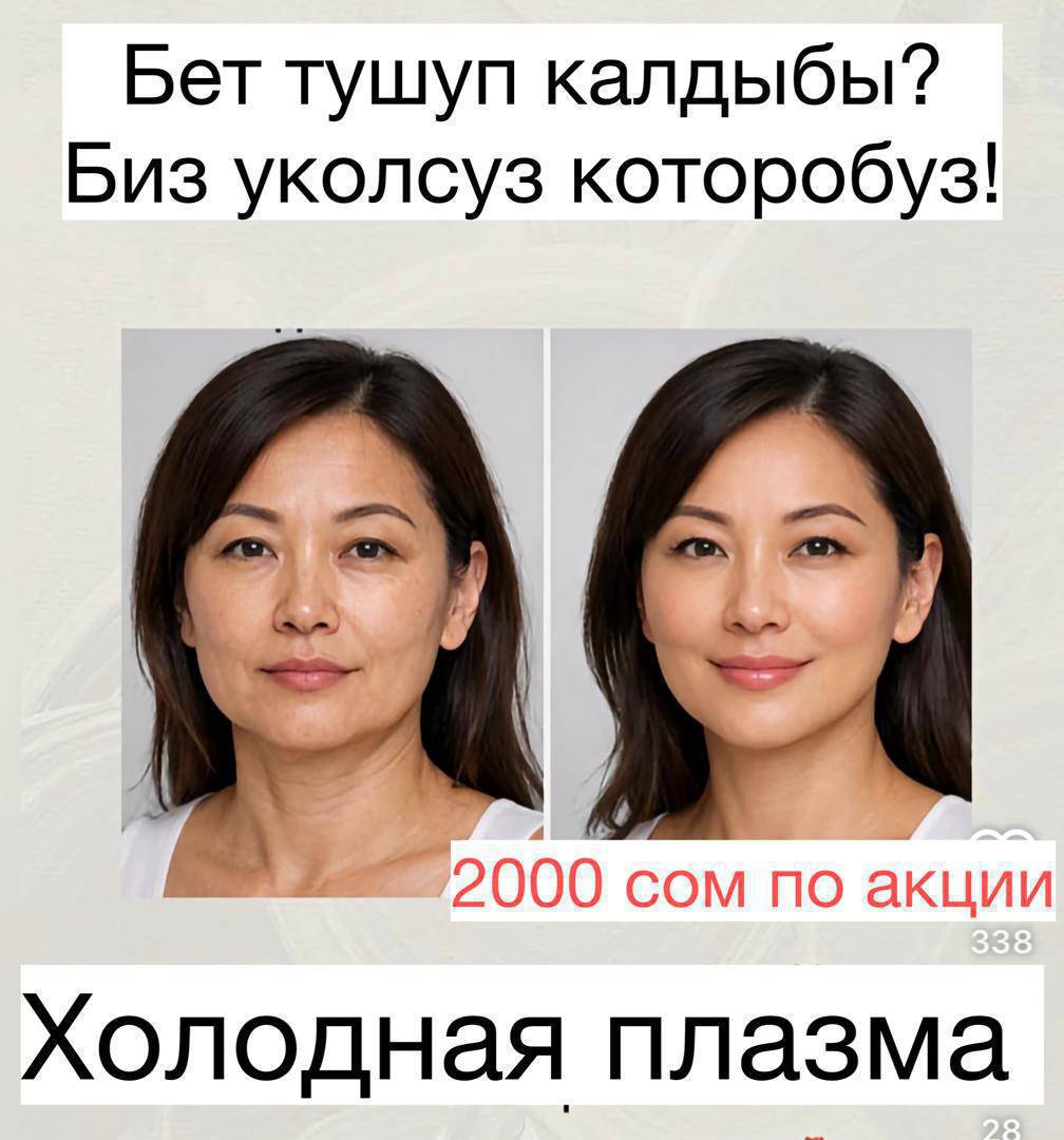 Муздак плазма -Терини жашартат Пигментацияны ж/а жөргөмүш тамырларды кетирет Тешикчелерди тарылышат угри жана исиркектерди дарылайт,
Беттин овалын чыңдап, бырыштарды азайтат, бир процедура кожаны 10 жылга жашартат !МАНИКЮР -500 с!КИРПИК-800с! ЧИСТКА ЛИЦА-600с Колтук тердоосун жыт кетируу- 1500 с Перманент макияжы брови- 1500 с, губы 1500с,2 жылга  очпос макияж!ламинация каш жана ламинация кирпик -400 с