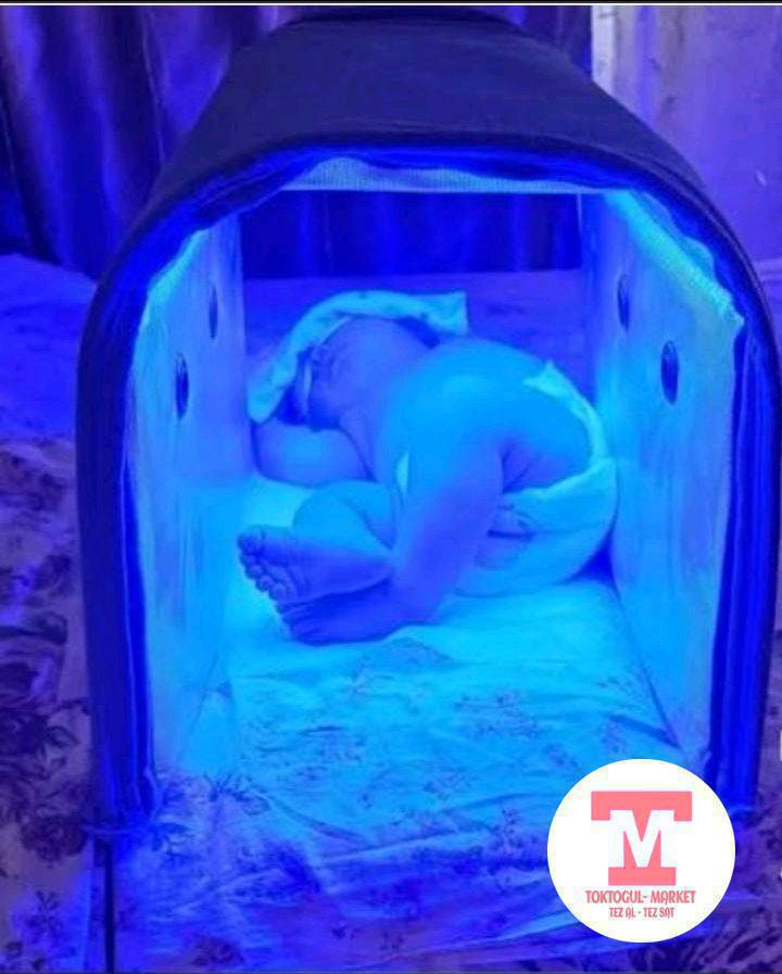 Фото лампа(желтухага) арендага берилет